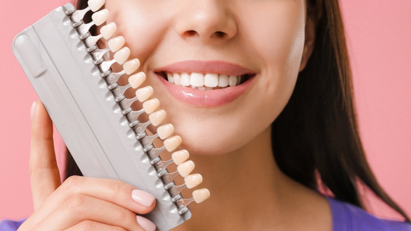Veneers: The Secret to Instant Confidence and Perfect Teeth